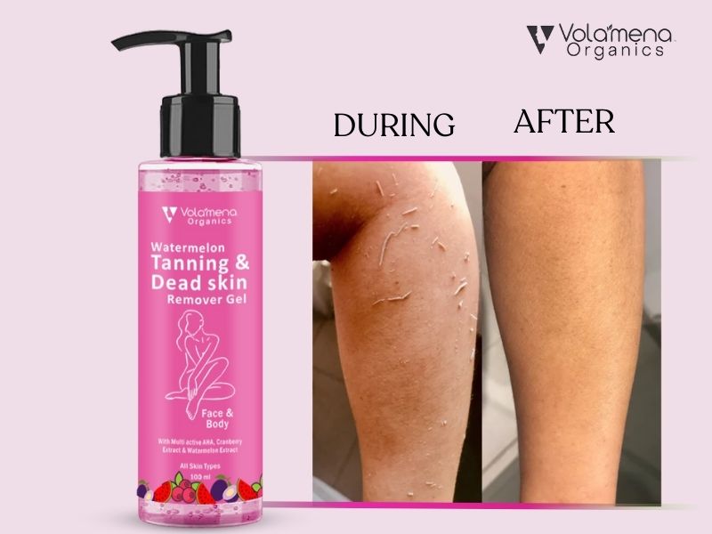 Watermelon Tanning & Dead skin Removal Gel For Face & Body | Visibly Tan Removal | Removes Dead Skin & Brighten Skin | Dead Skin Remover Gel For women & Men 100 ml