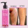 Watermelon Tanning & Dead skin Removal Gel For Face & Body | Visibly Tan Removal | Removes Dead Skin & Brighten Skin | Dead Skin Remover Gel For women & Men 100 ml Watermelon Tanning & Dead skin Removal Gel For Face & Body | Visibly Tan Removal | Removes Dead Skin & Brighten Skin | Dead Skin Remover Gel For women & Men 100 ml